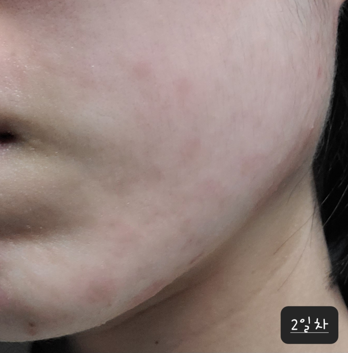 블리블리 (VELYVELY) 시카인진쑥 리페어 에센스 review image