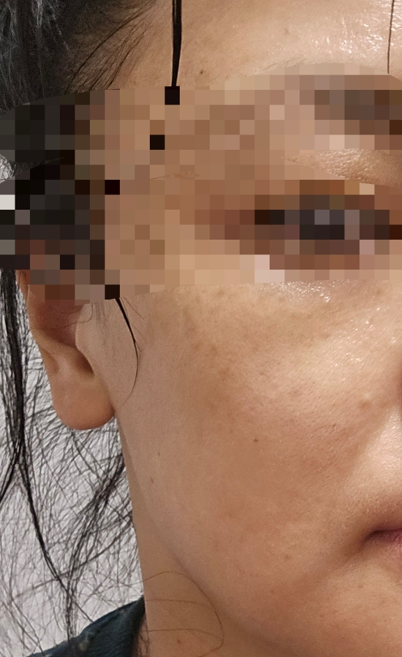 JHP코스메틱 (JHPCOSMETICS) 링클 앰플 [스네일콜라겐] review image