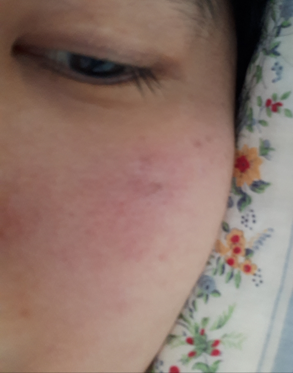 铷 慢老超级植物油精华液 common.review image