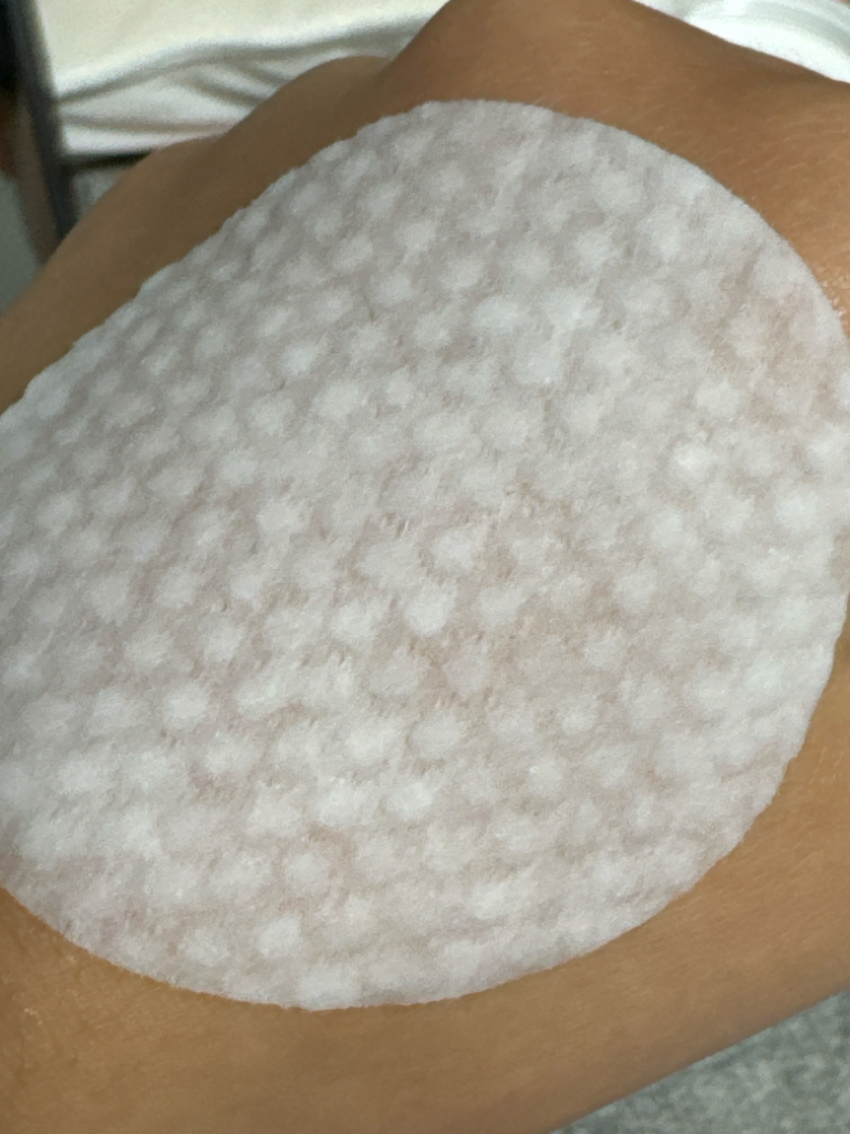 西卡修补剥离垫的真实用户使用照片
