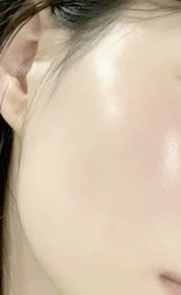 아마메르 (AMaMere) 4단계 주름앰플 review image