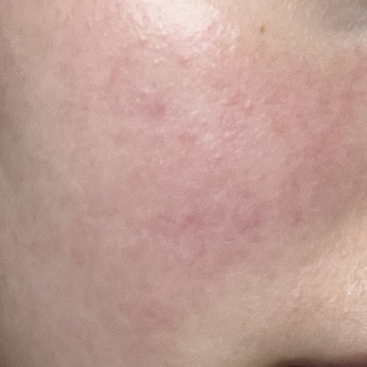 屏障修复霜的真实用户使用照片