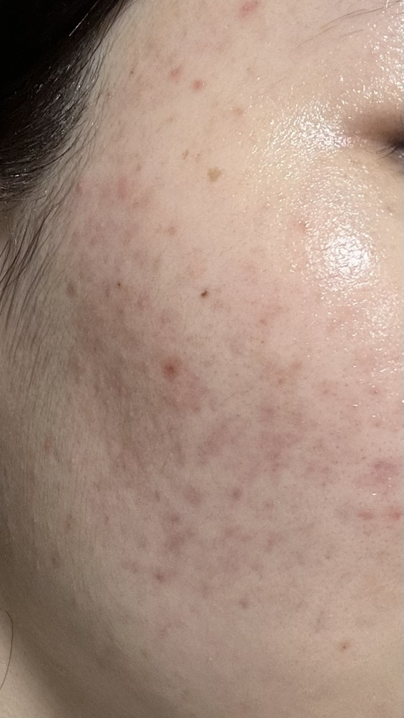 REMAIN49 肌肤精华修复300克 common.review image