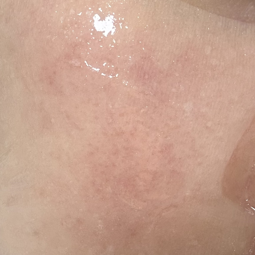 专业安瓿面膜[玻尿酸补水]的真实用户使用照片
