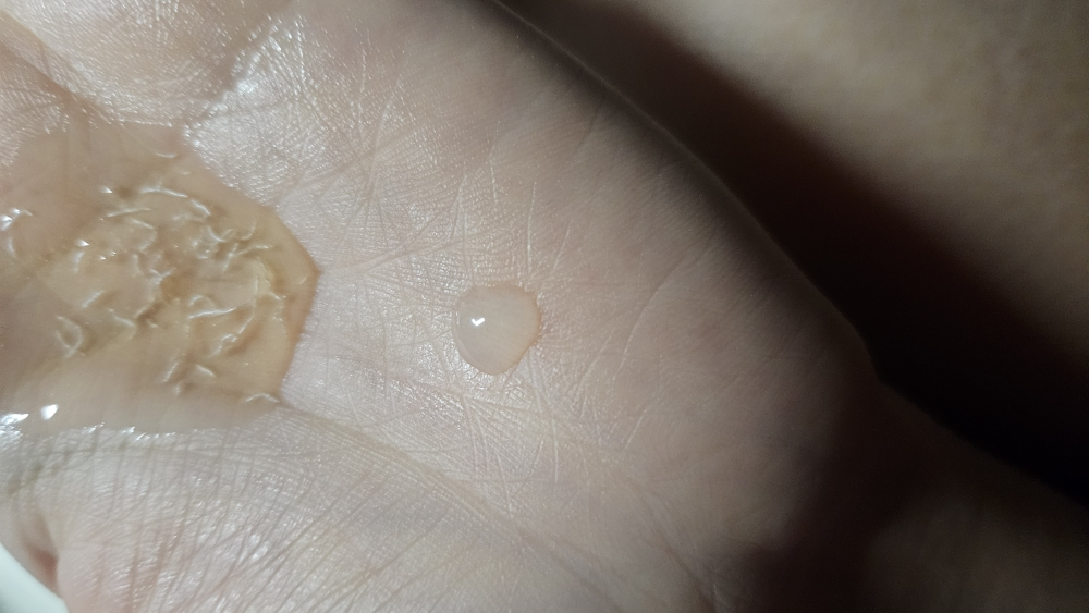 巴库乔尔精华液 10000ppm 浓缩液的真实用户使用照片