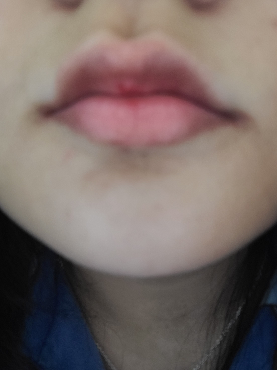 립리프 (Liplief) 스티밍 립밤 [얼라이브] review image