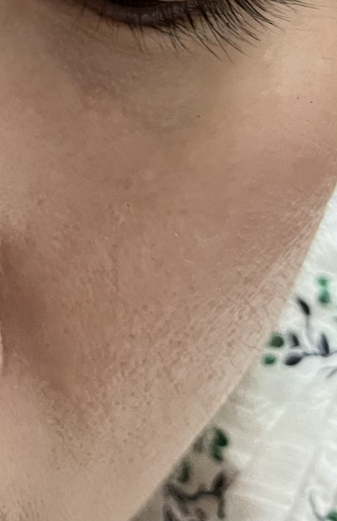 CICA积雪草保湿棉片的真实用户使用照片