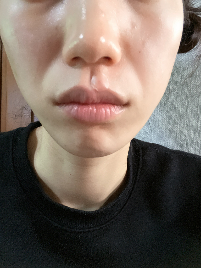 일소 (ilso) 듀얼 카밍 스팟 패치 review image