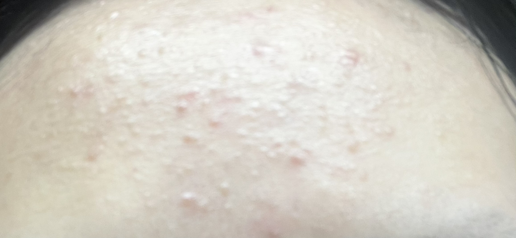 地泛醇 15.5 乳膏的真实用户使用照片