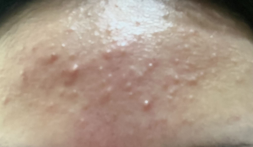 地泛醇 15.5 乳膏的真实用户使用照片