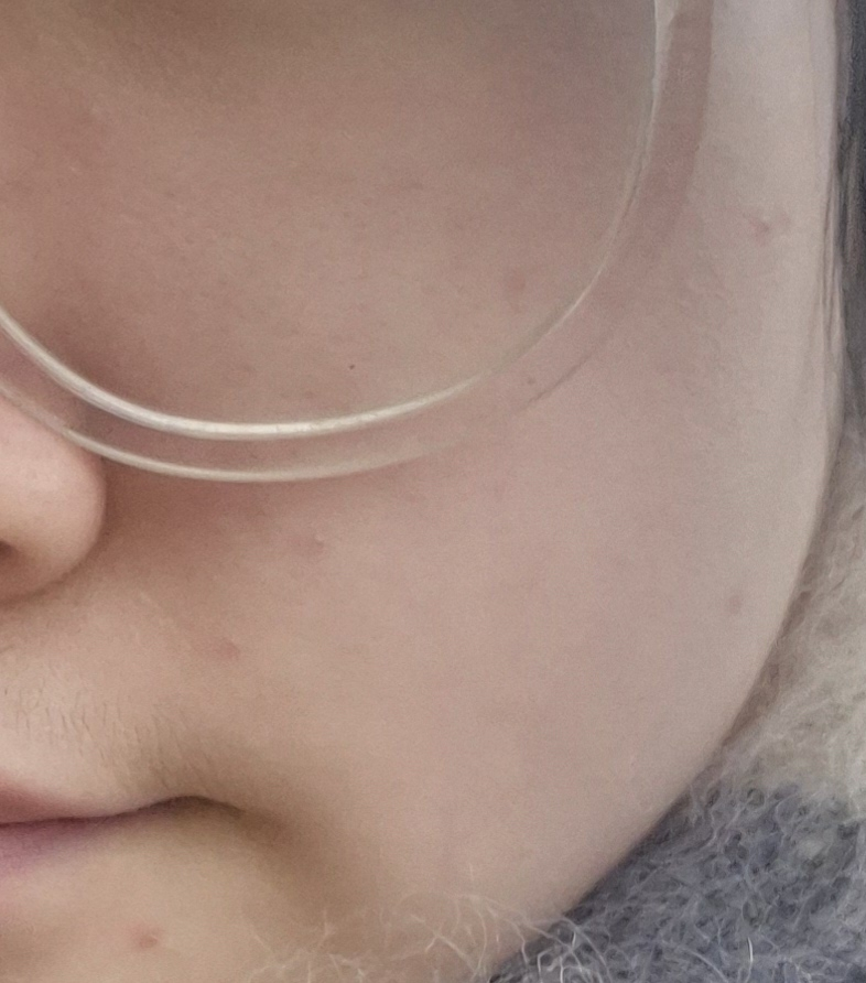 碧研菲 问题解决方案 纯素精华 common.review image