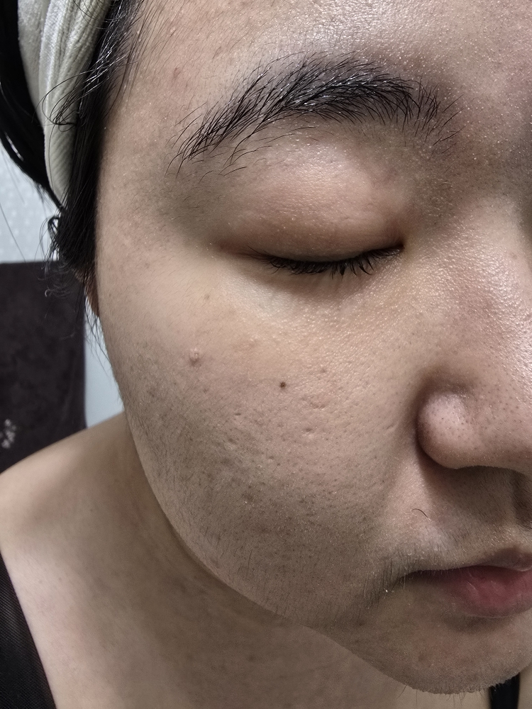더마힐 (Dermaheal) 포밍클렌저 review image