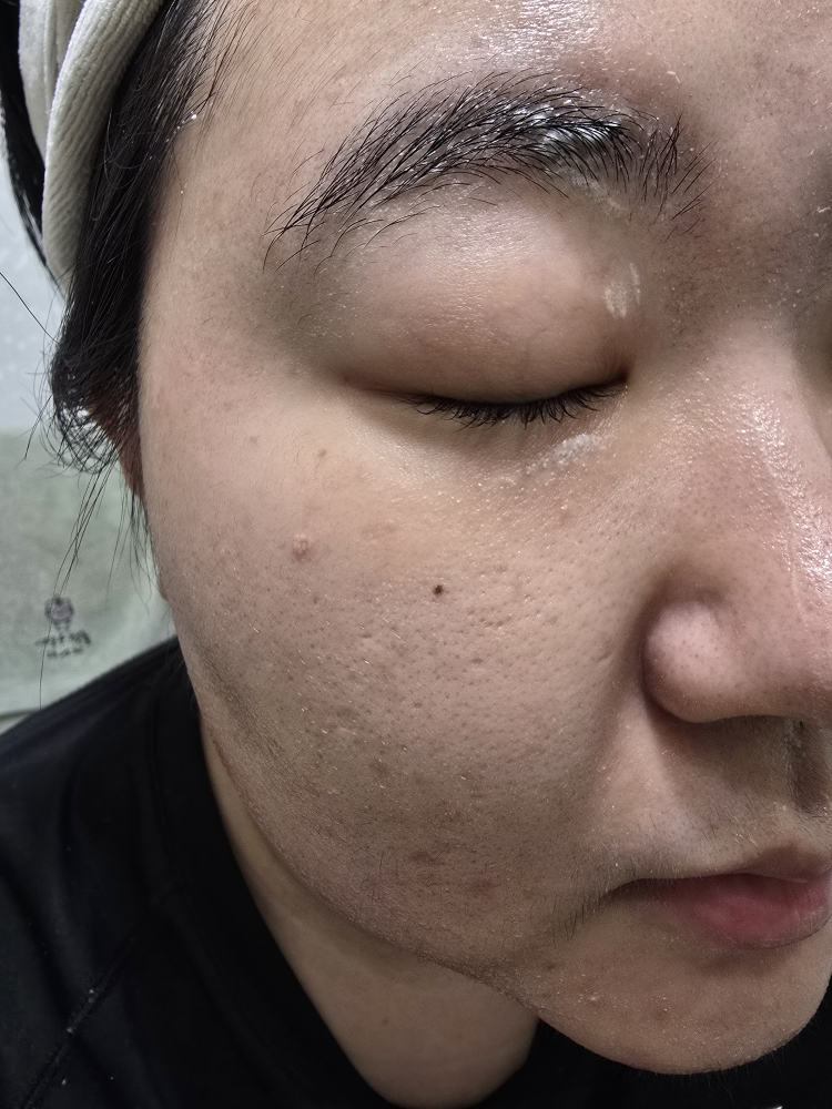 W.피부연구소 (W.SKINLABORATORY) AC+ 트러블 클리어링 클렌징폼 review image