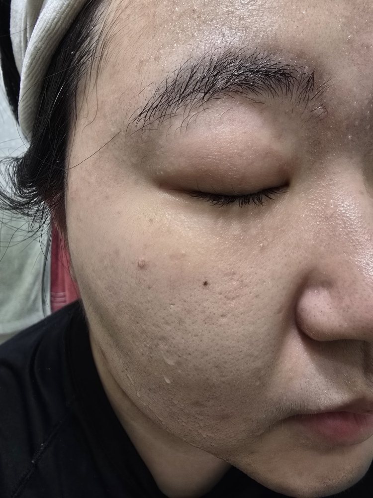 W.피부연구소 (W.SKINLABORATORY) AC+ 트러블 클리어링 클렌징폼 review image