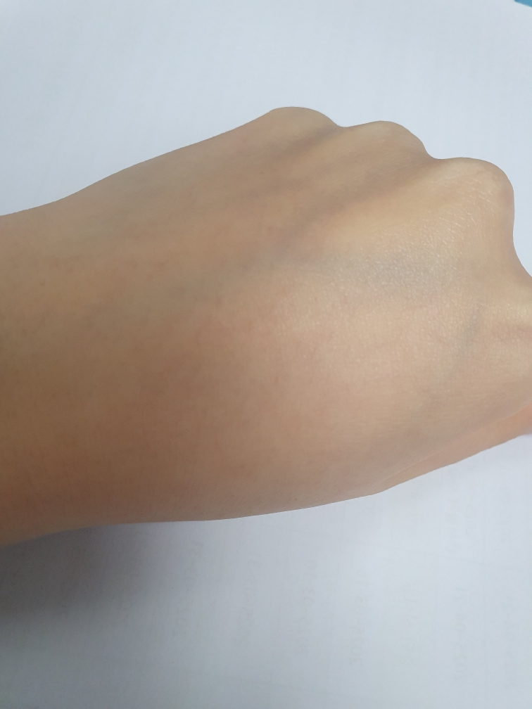 巴库奇奥尔10,000ppm(1%)乳霜的真实用户使用照片