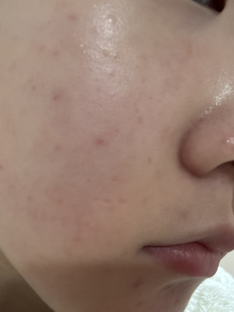 락토덤 (LACTO-DERM) 피부에 유익한 어성초 수분 크림 review image