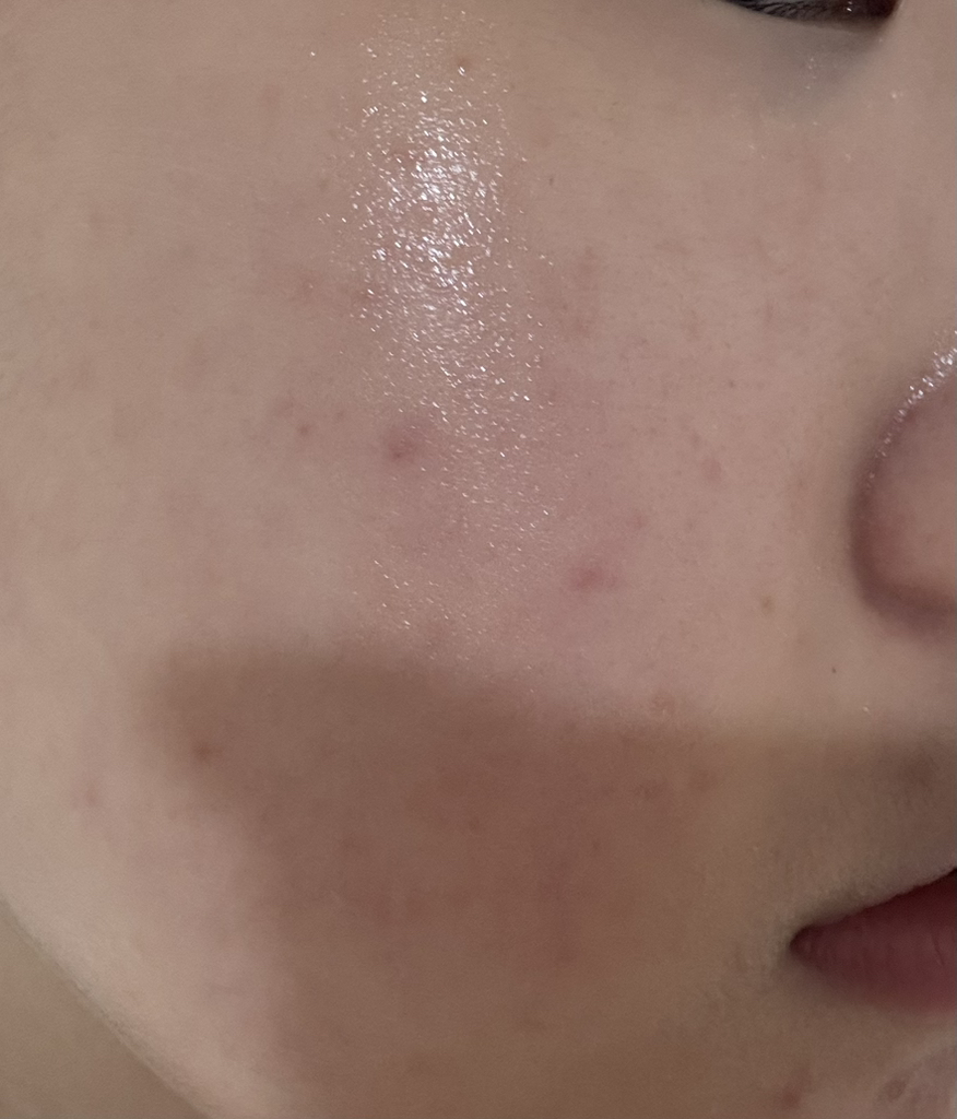 락토덤 (LACTO-DERM) 피부에 유익한 어성초 수분 크림 review image