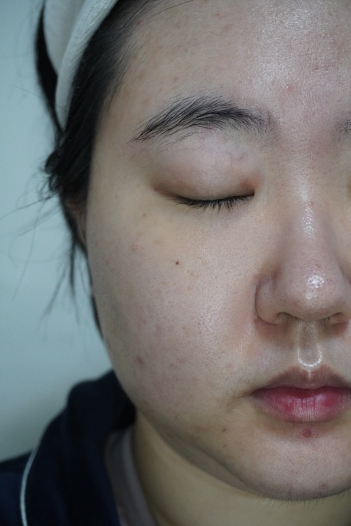 Real user review photo of Mandelic Acid 5% Skin Prep Water
