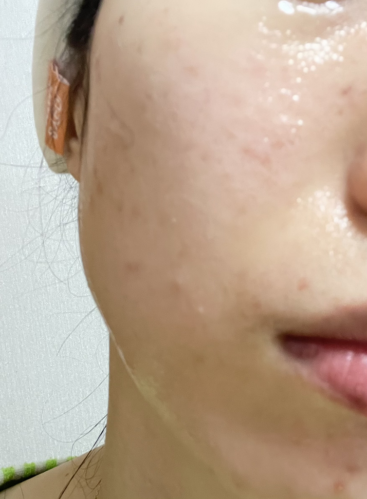 티엘스 (T'else) 블랙 빈 세라마이드 세럼 review image