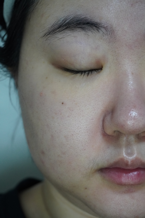 스타라이크 (starlike.) 글로우 컨센트레이트 세럼 review image