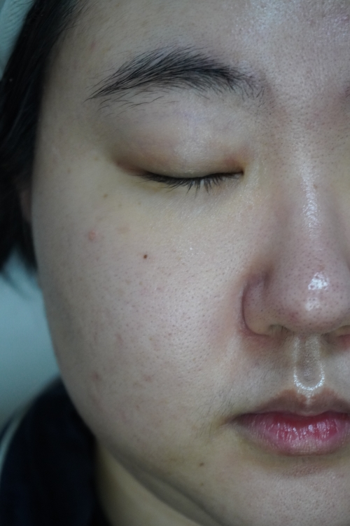 스타라이크 (starlike.) 리뉴 플럼핑 세럼 review image