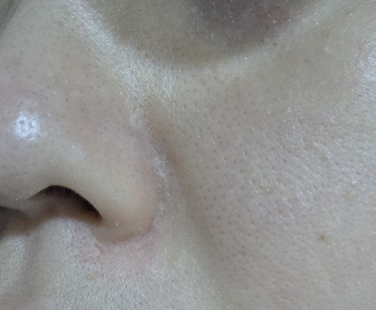 星形 烟酰胺 21 毛孔精华液 review image