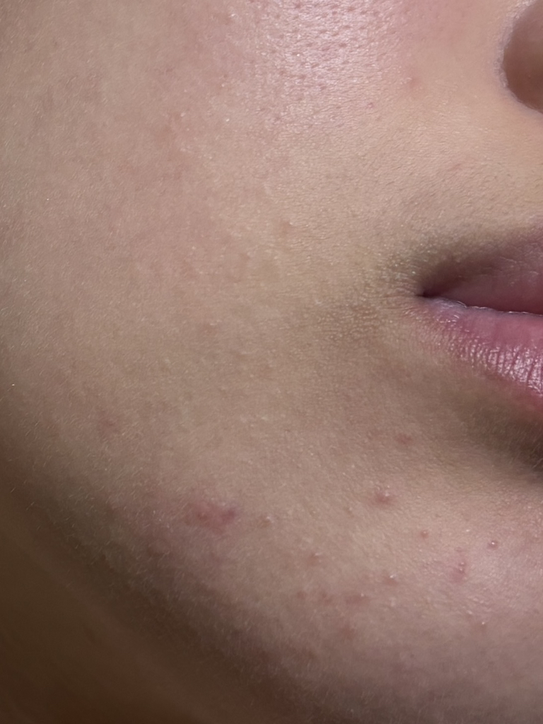 Real user review photo of Essential Mool Cream Light