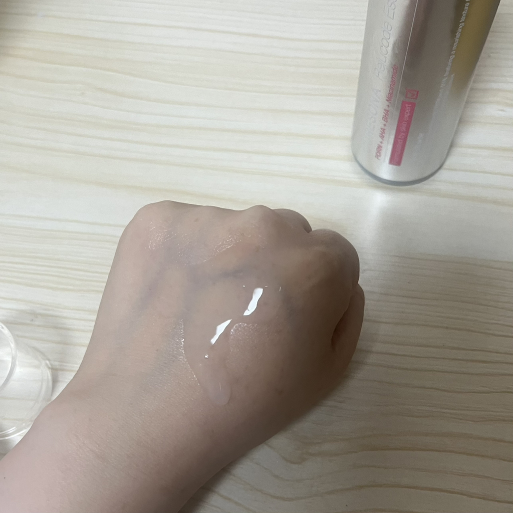 Rijkode Essenstooner的真实用户使用照片