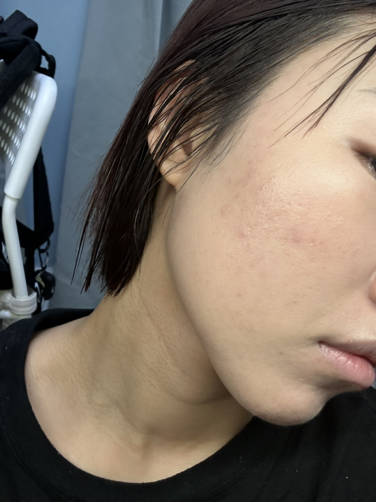 泛醇温和防晒霜 [SPF50+/PA++++]的真实用户使用照片
