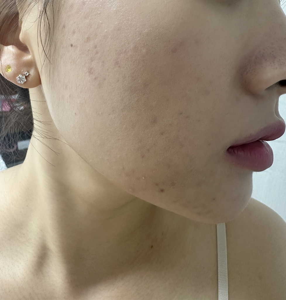 缪泽纳安瓶水光气垫 [SPF50+/PA+++] [21号 浅米色]的真实用户使用照片
