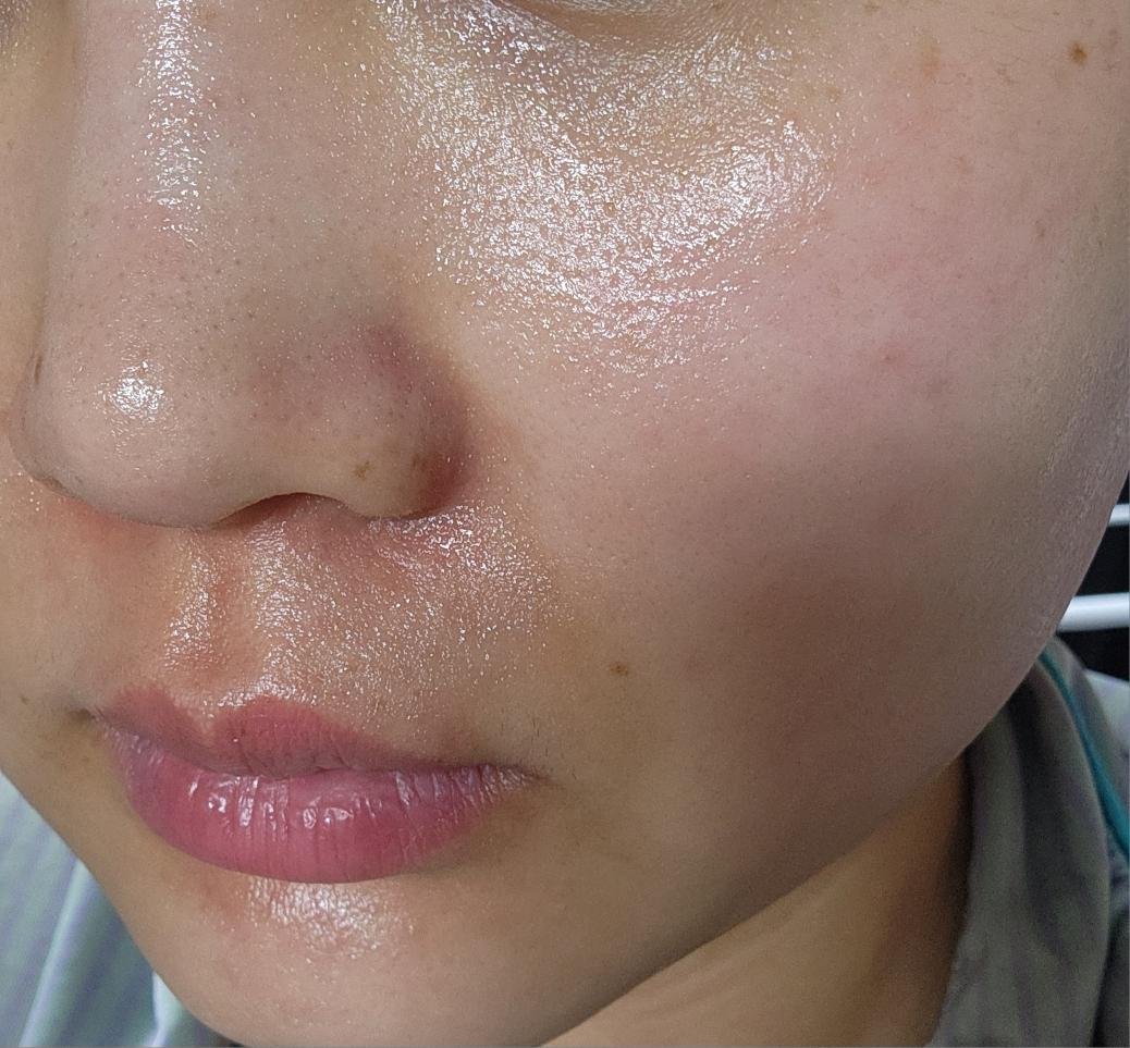 이니스프리 (INNISFREE) 에너지 마스크 [어성초] review image