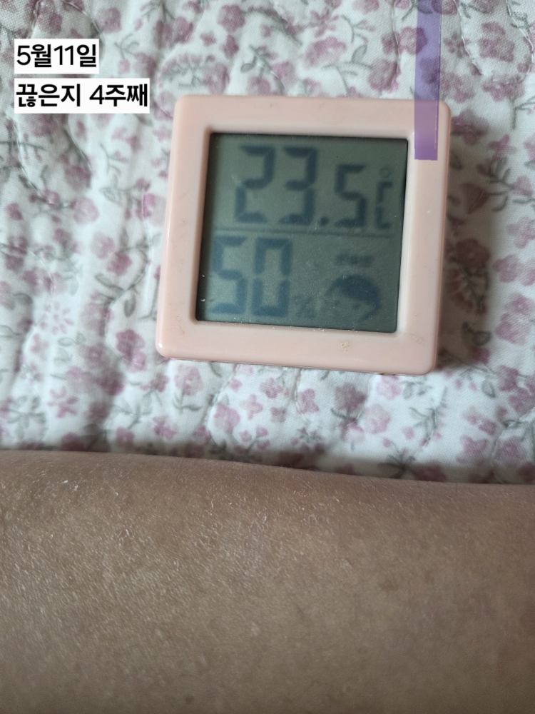 엔젯오리진 (nzOrigin) 데일리 모이스처 히알루론산 review image