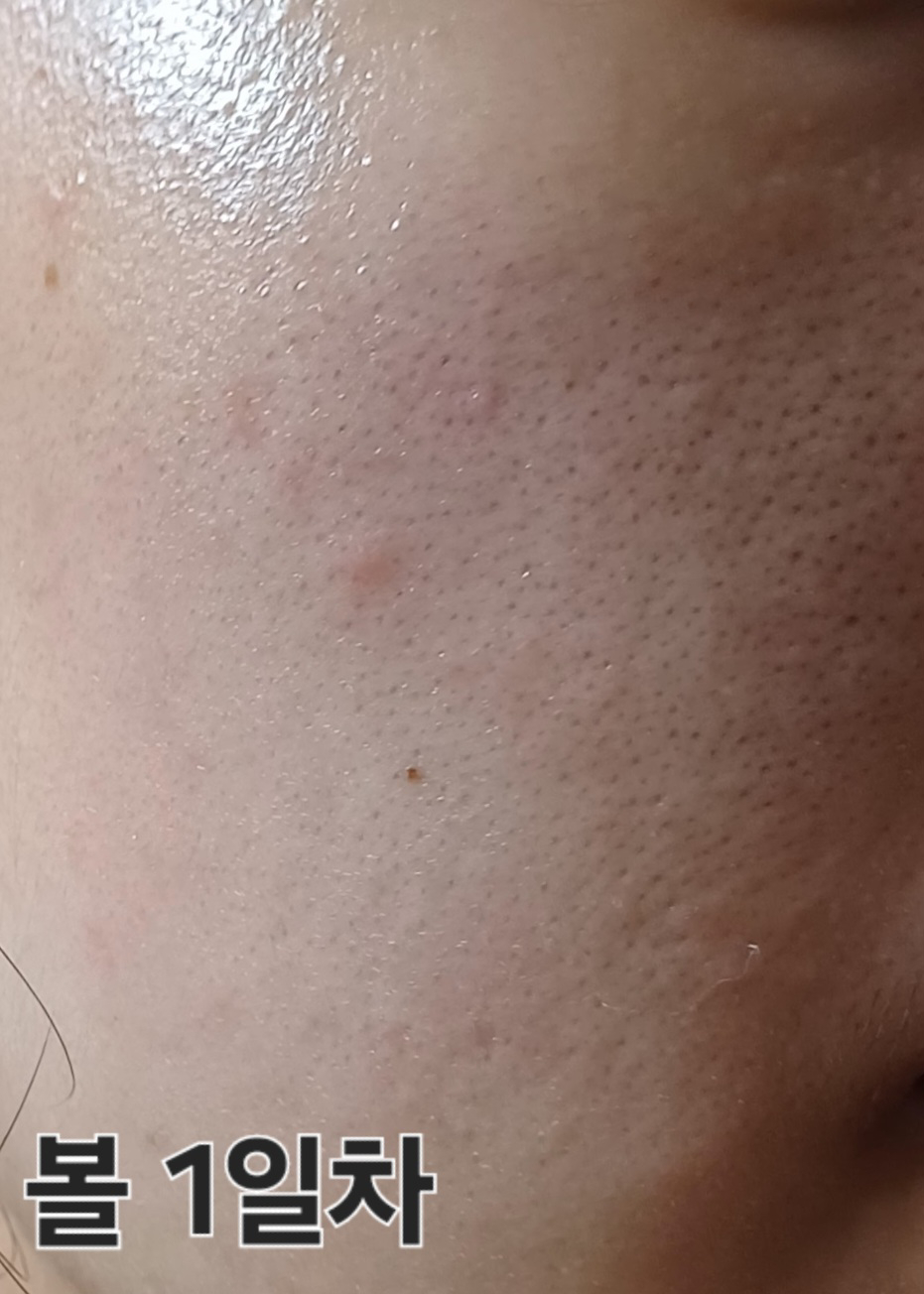 파파레서피 (Paparecipe) 리얼 센텔라 시카 카밍 세럼 review image