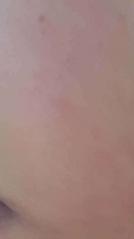 피터앤랩스 (PETERANDLABS) 나이아신아마이드 닥나무 잡티 세럼 review image