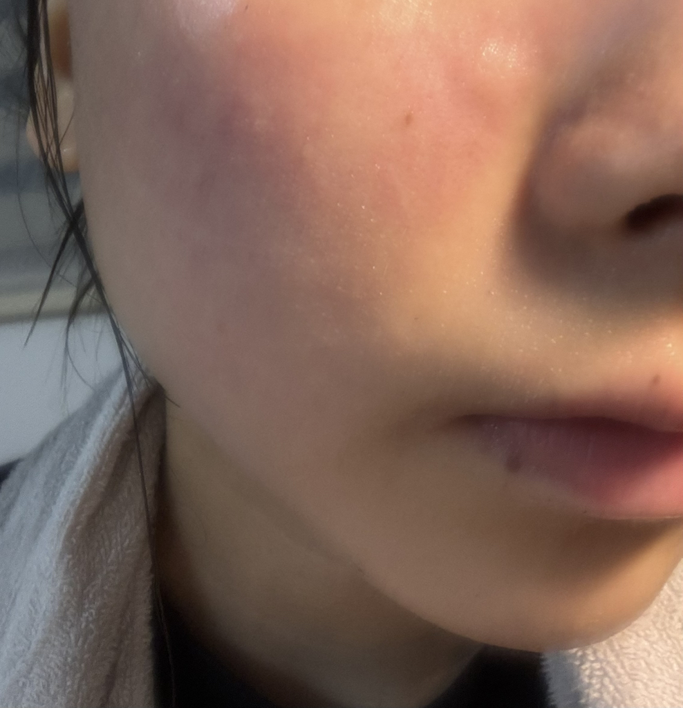 Bepanthol 皮肤 SOS 修复多功能面霜 common.review image