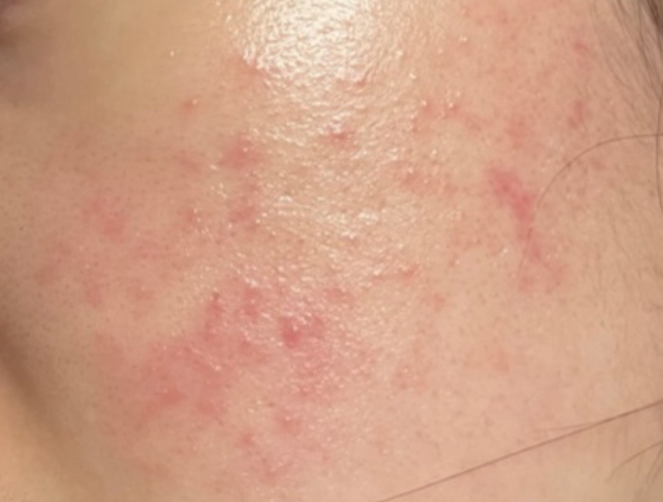 SIDMOOL D-PANTHENOL CREAM review image