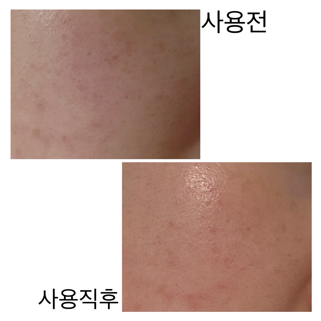 미즈온 (MIZON) 7비건 펩타이드 부스터 세럼 review image