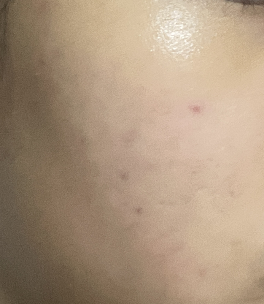 维他命补充剂胶囊精华的真实用户使用照片