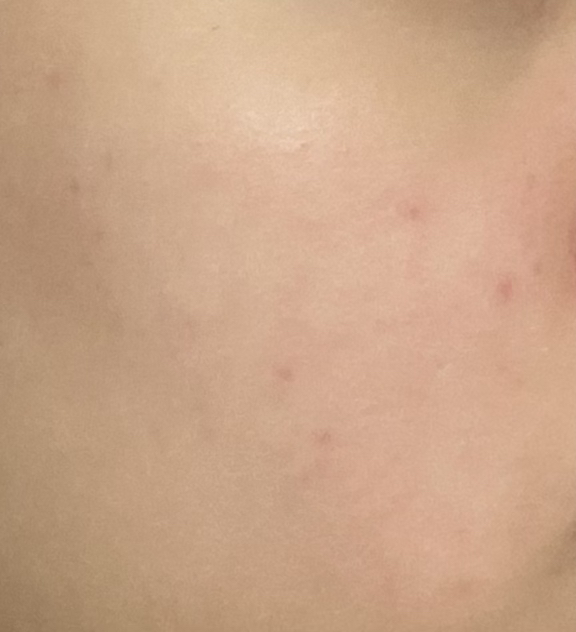 维他命补充剂胶囊精华的真实用户使用照片