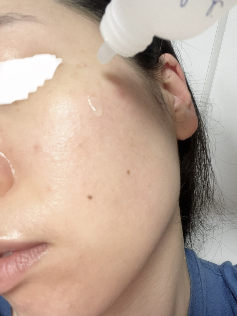 더랩바이블랑두 (THELABbyblancdoux) 올리고 히알루론산 딥 글로우 세럼 review image