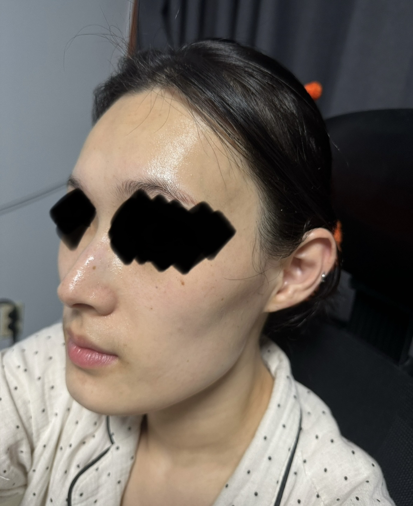 脂质体修复乳霜的真实用户使用照片