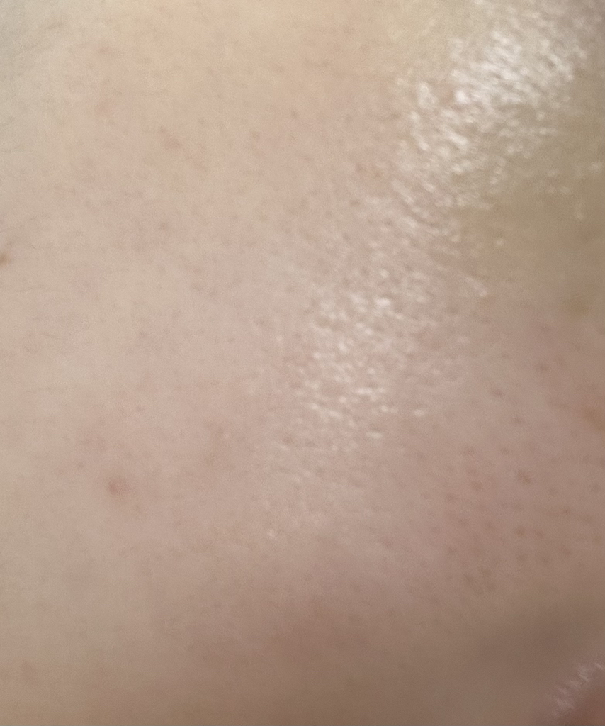 瑞德尔肖特S50面部提升首要安瓿液[胶原蛋白]的真实用户使用照片