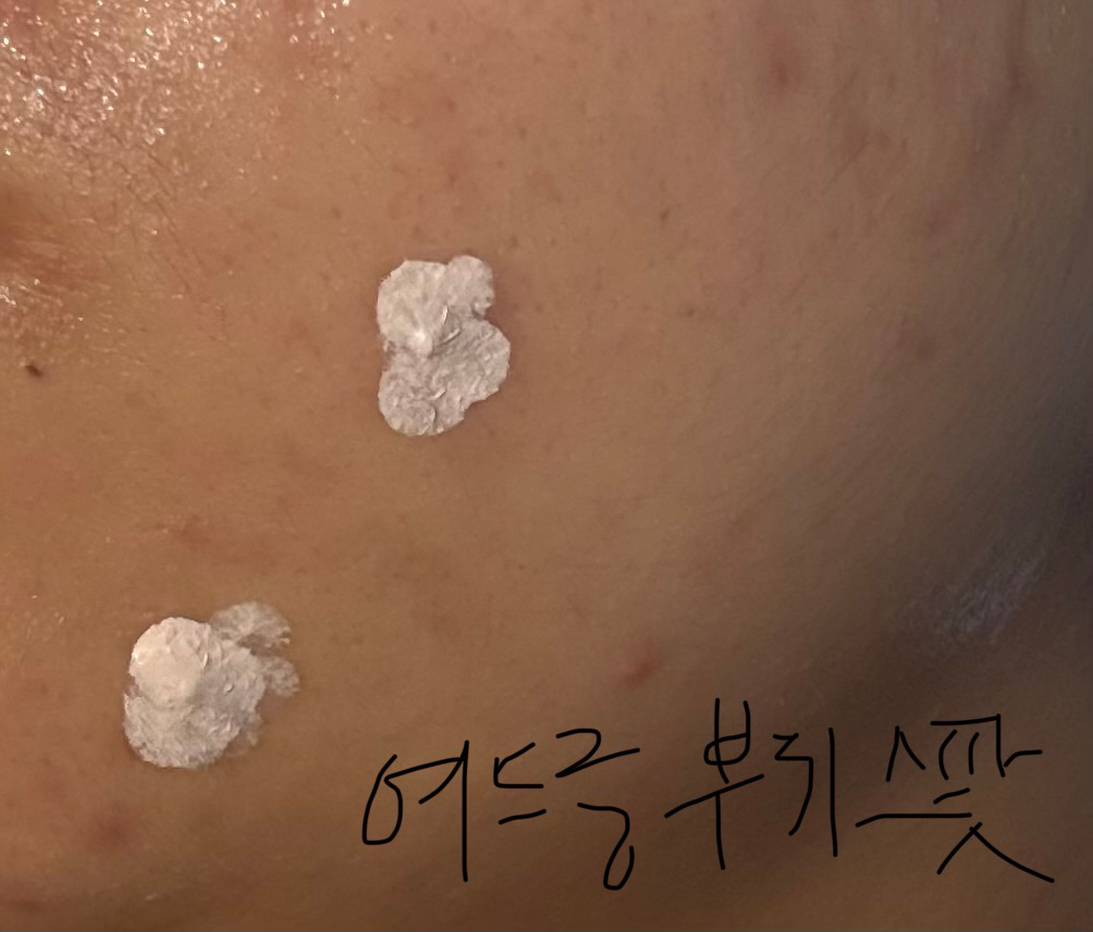 控制A™ 茶树疗程舒缓护理的真实用户使用照片
