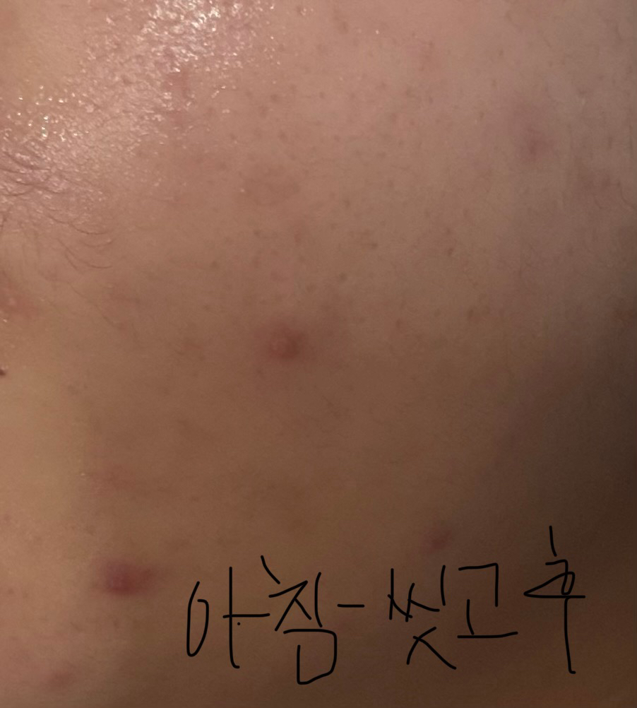 控制A™ 茶树疗程舒缓护理的真实用户使用照片