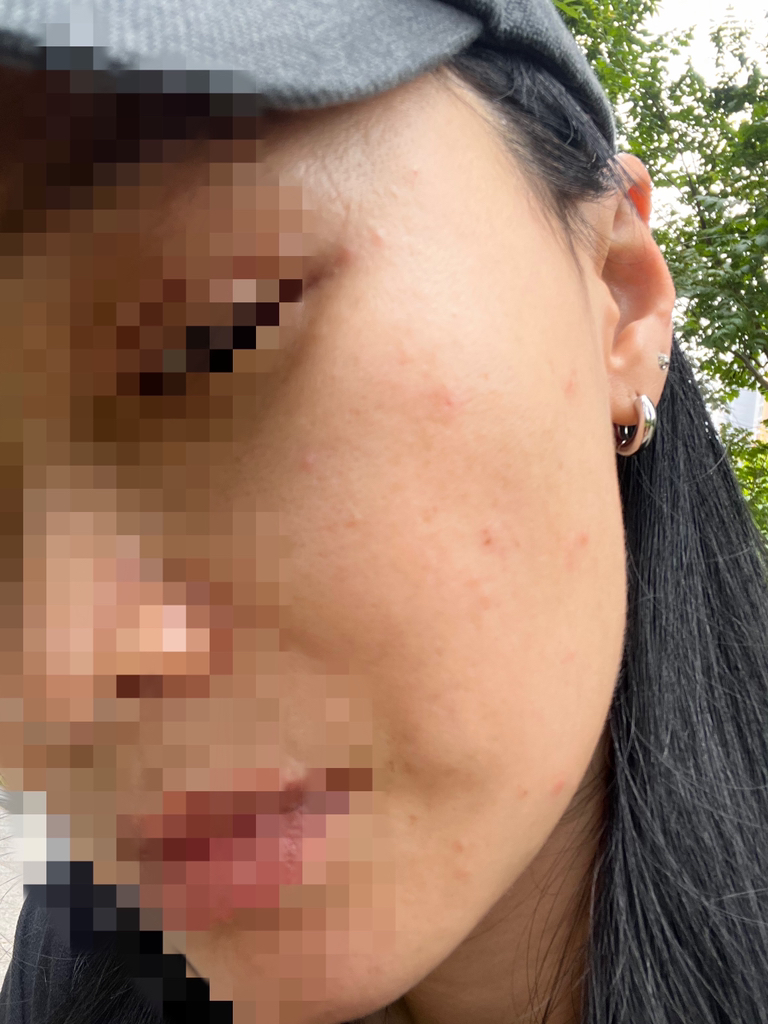 Real user review photo of Silk Peptide Intensive Lifting Ampoule