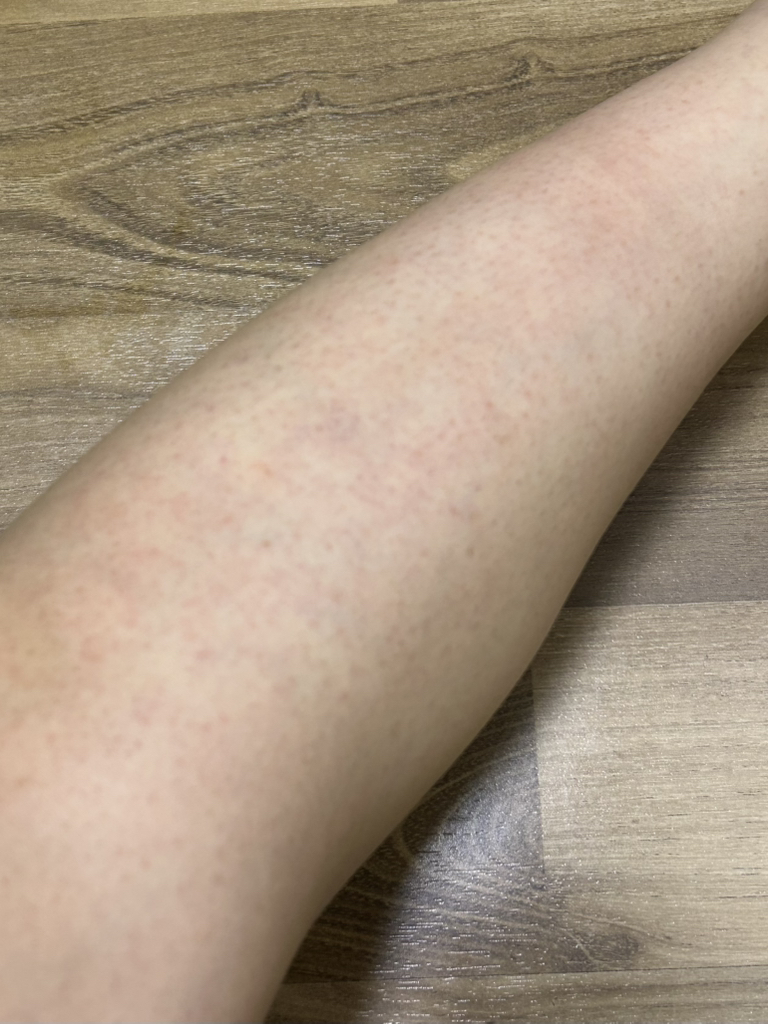 세타필 (Cetaphil) 각질제거 SA 로션 review image