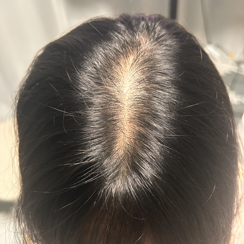 정직한실험실 (True.LAB) 시카 스캘프 샴푸 review image