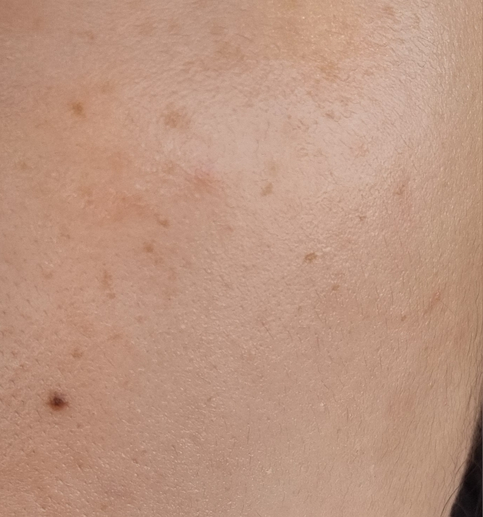 Dr.G VITA CLEAR Sun Serum [SPF50+/PA++++] review image