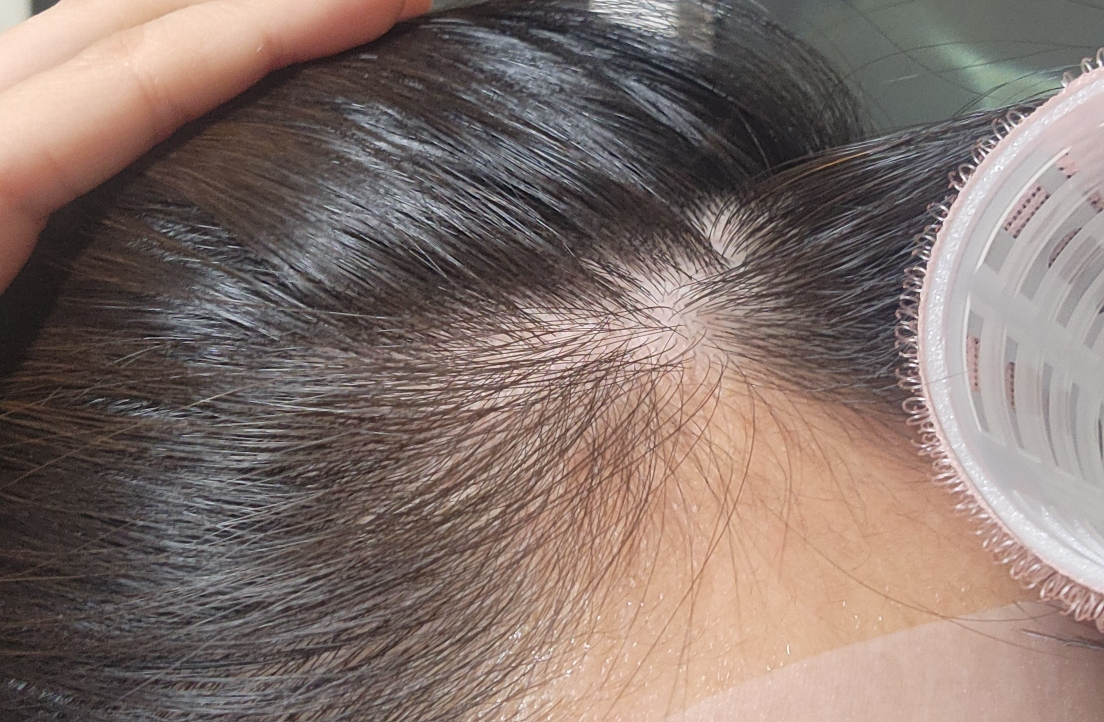 아워덤 (OURDERM) 노모어 헤어로스 부스트 앰플 review image