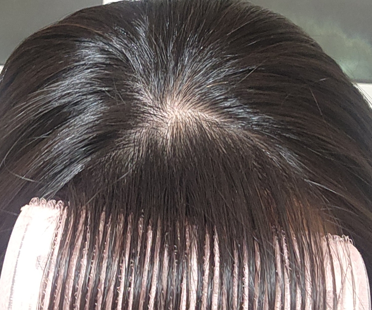 아워덤 (OURDERM) 노모어 헤어로스 부스트 앰플 review image